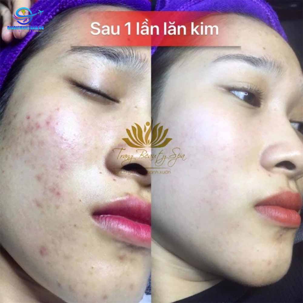 Trang Beauty Spa làm đẹp tại Nam Định