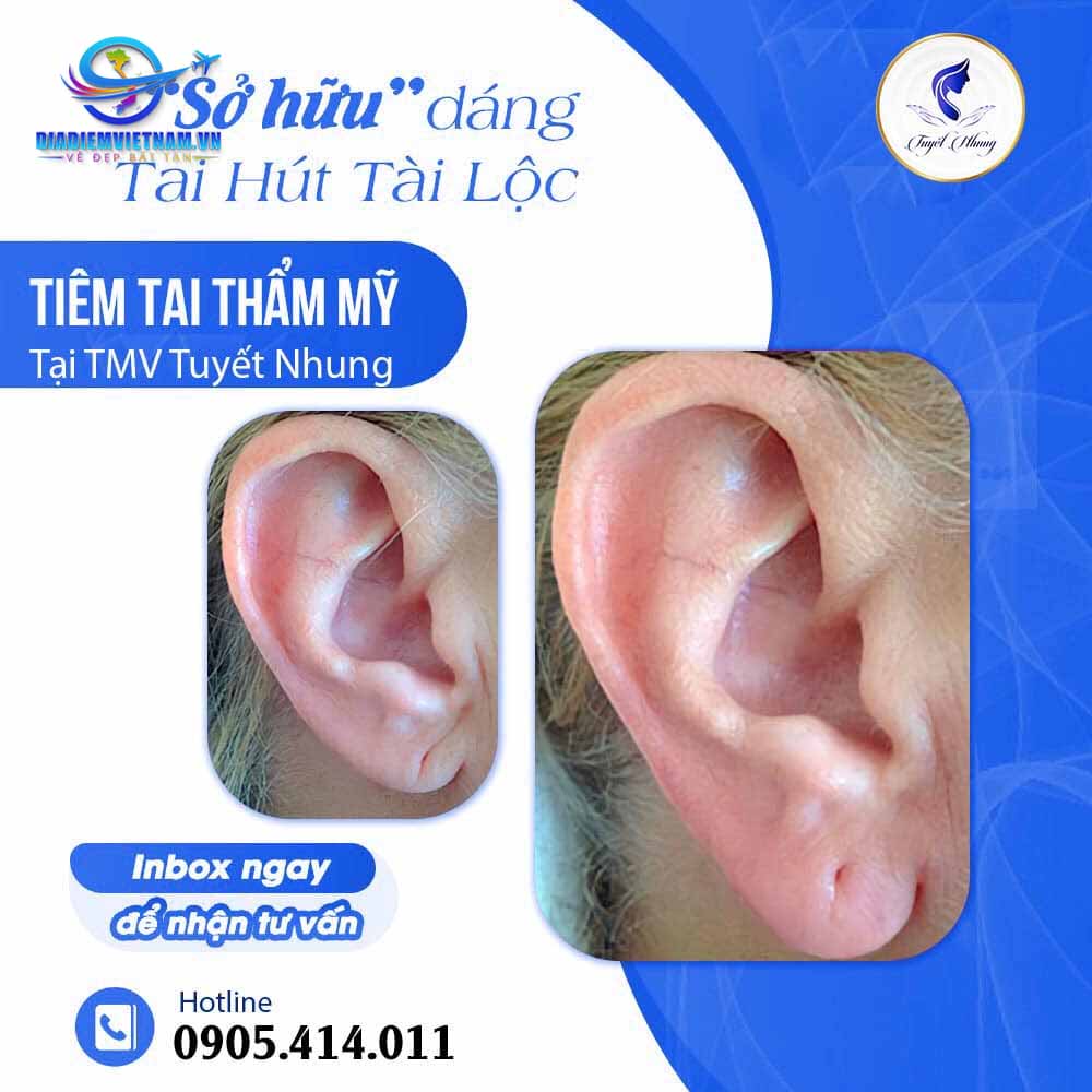 Tuyết Nhung - Thẩm mỹ viện tại Đà Nẵng