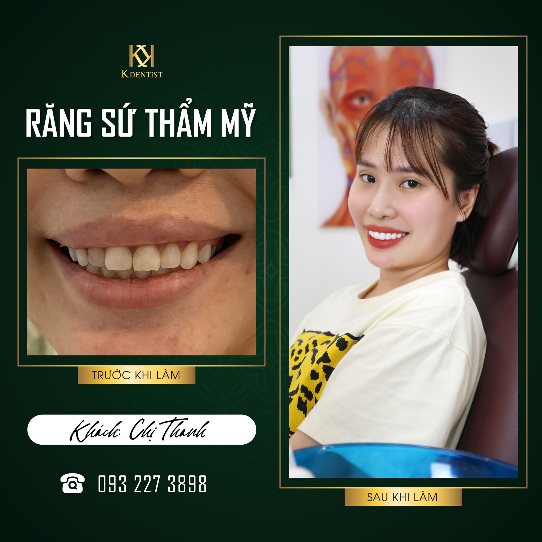 Nha khoa Quốc tế K Dentist – phòng khám nha khoa Quảng Ngãi